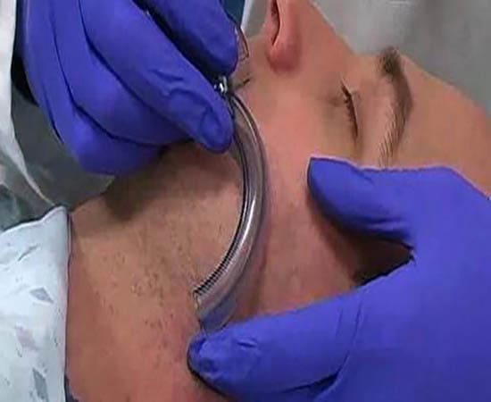 Хирургические методы обеспечения проходимости дыхательных путей