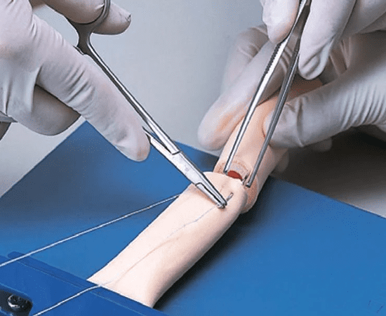 Кишечный шов