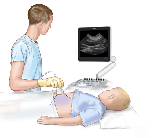 УЗИ брюшной полости. Базовые навыки