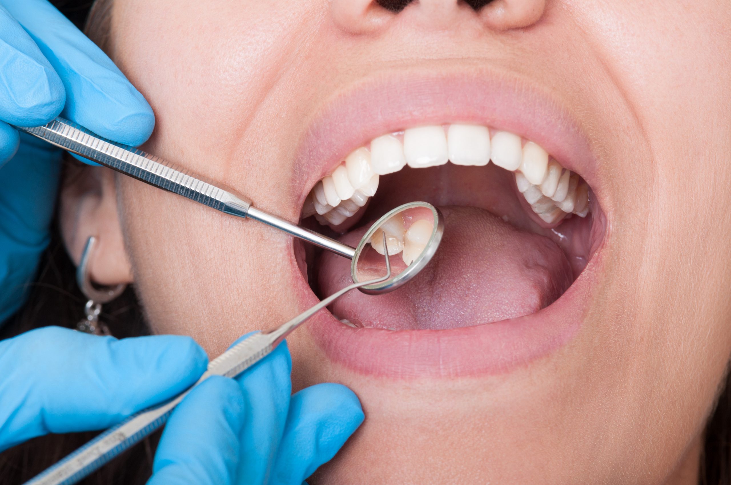 Обучение на стоматолога: нюансы переподготовки, содержание курса и учебное заведение